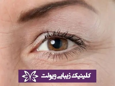 بهترین کلینیک زیبایی در تهران